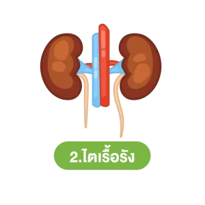 กินโซเดียมเยอะผลเสีย อย่างที่ 2.ไตเรื้อรัง